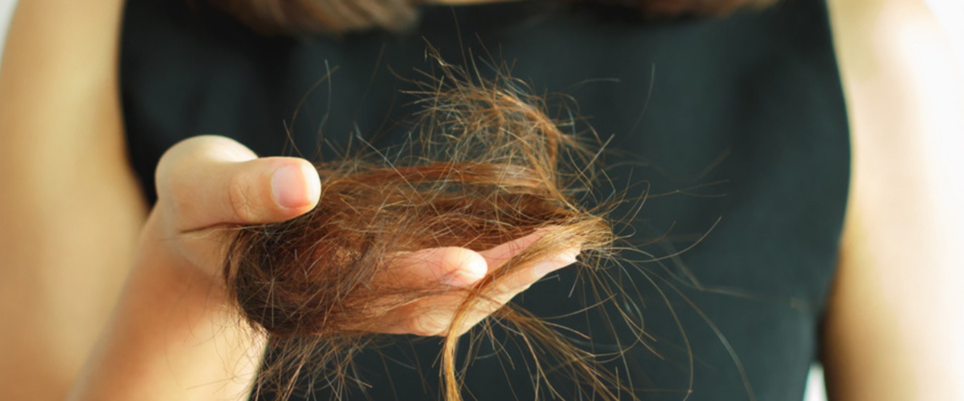 How long does hair loss last after weight loss?