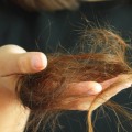 How long does hair loss last after weight loss?